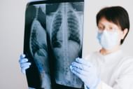 An X-ray of the chest often does not indicate latent TB, hence it can be quite difficult to diagnose this disease (Image via Pexels @Anna Shvets)
